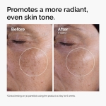 The Ordinary Glycolic Acid 7% Exfoliating Toner, Brightening and Smoothing Daily Toner for More Even-Looking Skin Tone, 8.1 Fl Oz - Image 6